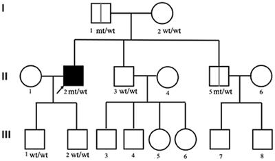 Case report: A variant of the FIG4 gene with rapidly progressive amyotrophic lateral sclerosis